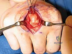 حالة سريرية 2