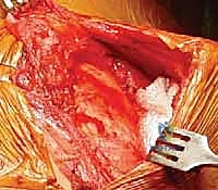 تشريح مفصل الكتف الصدري