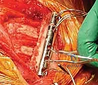 النتيجة النهائية داخل غرفة العمليات