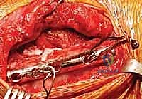 برنامج التأهيل الطبيعي بعد الجراحة