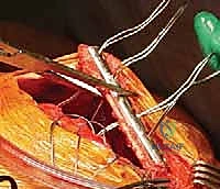 إدارة المضاعفات المحتملة