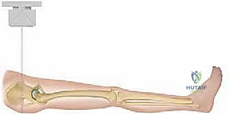 التخطيط الجراحي المتقدم ورسم خريطة العائق