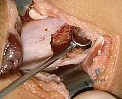 الرعاية ما بعد الجراحة والمتابعة الدورية بالأشعة