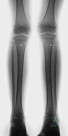 صورة توضح التعامل مع المضاعفات المحتملة