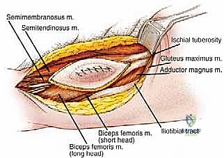 تجهيز المريض في غرفة العمليات