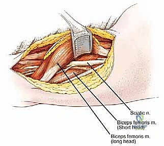 التخطيط الجراحي متعدد التخصصات قبل العملية
