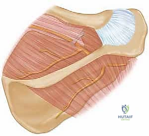 توضيح سريري لضمور العضلات المحيطة بلوح الكتف