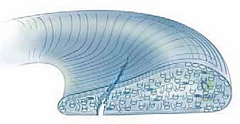 صورة توضح تمزق مقبض الدلو والانغلاق الميكانيكي