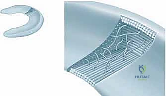 الأستاذ الدكتور محمد هطيف أثناء إجراء عملية بالمنظار