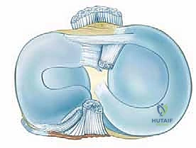 خيارات العلاج التحفظي مقابل الجراحي