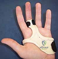 Open Reduction and Internal Fixation of Phalangeal Condylar Fractures: An Intraoperative Masterclass