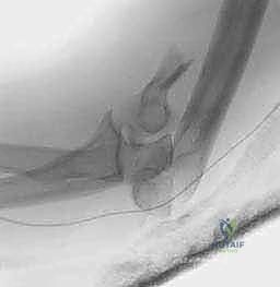 وضعية المريض في الجراحة