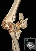 الخيارات العلاجية
