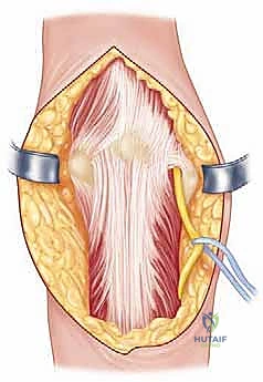 تشريح مفصل الكوع