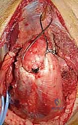 الأعصاب والأوعية الدموية في الكوع