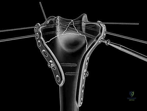 الدكتور محمد هطيف