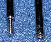 علاج الالتحام الكاذب الخلقي في قصبة الساق بقضيب ويليامز: دليل شامل للمرضى