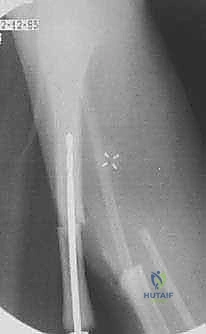 ميكانيكية عمل قضيب ويليامز