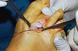 أدوات التشخيص والفحص السريري للقدم