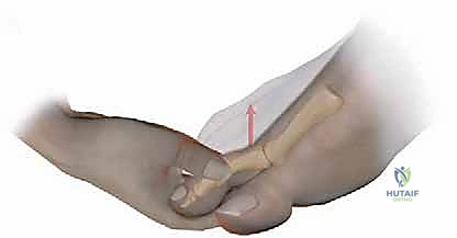 الأربطة والأوتار المحيطة بمفاصل القدم