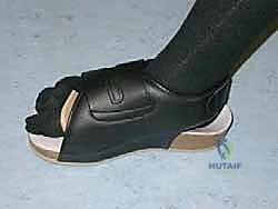 Mastering the Weil Lesser Metatarsal Shortening Osteotomy: An Intraoperative Guide