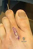 التحضير للتدخل الجراحي الدقيق