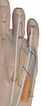 استخدام التقنيات المتقدمة في غرفة العمليات