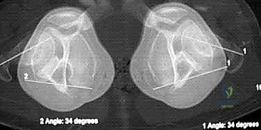 صورة توضيحية للفحص السريري الدقيق في العيادة