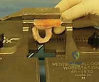 أنواع التمزقات الحادة