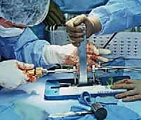 مناطق التروية الدموية للغضروف