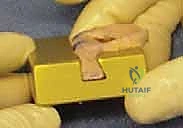 صورة رنين مغناطيسي توضح موانع الجراحة