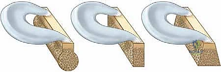 تقييم استقامة الساق قبل الجراحة