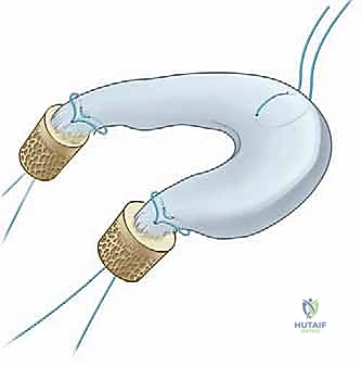دليل الحفر الموجه