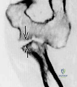 أحدث تقنيات جراحة العظام والمفاصل في اليمن