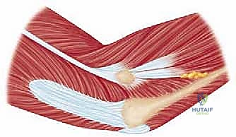 فحص المرفق وتقييم الألم