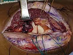 الأستاذ الدكتور محمد هطيف أفضل جراح عظام في صنعاء