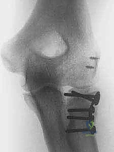 التشخيص بالأشعة السينية والمقطعية