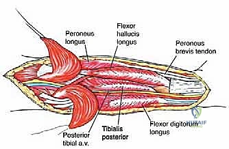 استخدام التصوير الطبي المتقدم لتحديد موقع الورم بدقة