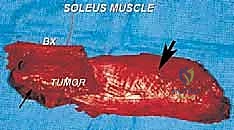 الاجتماع الطبي متعدد التخصصات وتحديد خطة العلاج المثلى