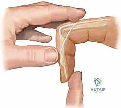 صورة توضح تقييم الأشعة السينية واستراتيجية التشخيص