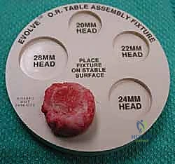 صورة توضيحية لـ جراحة استبدال رأس الكعبرة المعيارية: حل مبتكر لإصابات الكوع المعقدة مع الأستاذ الدكتور محمد هطيف