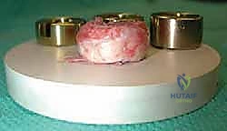 صورة طبية: جراحة استبدال رأس الكعبرة المعيارية: حل مبتكر لإصابات الكوع المعقدة مع الأستاذ الدكتور محمد هطيف