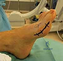 الأستاذ الدكتور محمد هطيف في غرفة العمليات