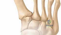 تصلب المفاصل وصعوبة الحركة