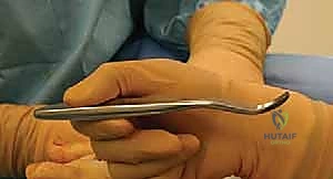 ارتداء الحذاء الجراحي الخاص