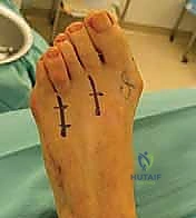 النتيجة الفورية لمحاذاة الأصابع