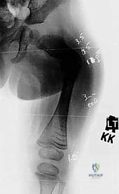 تقنيات الجراحة الحديثة في عيادة الدكتور محمد هطيف