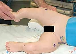 العلاج الدوائي والتحفظي لهشاشة العظام