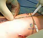 نتائج مبهرة قبل وبعد الجراحة