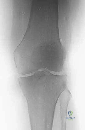 تقييم الألم عند المرضى